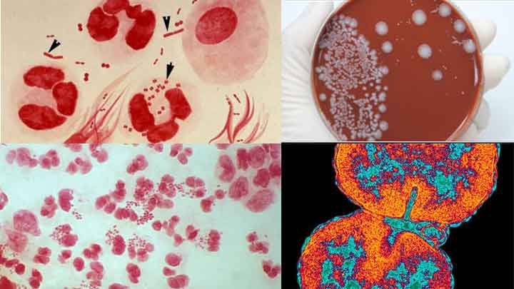 Sự hình thành và sinh sản của vi khuẩn | Vinmec